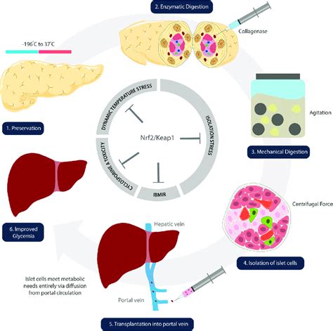 Schematic illustration denoting steps of islet cell transplantation ...