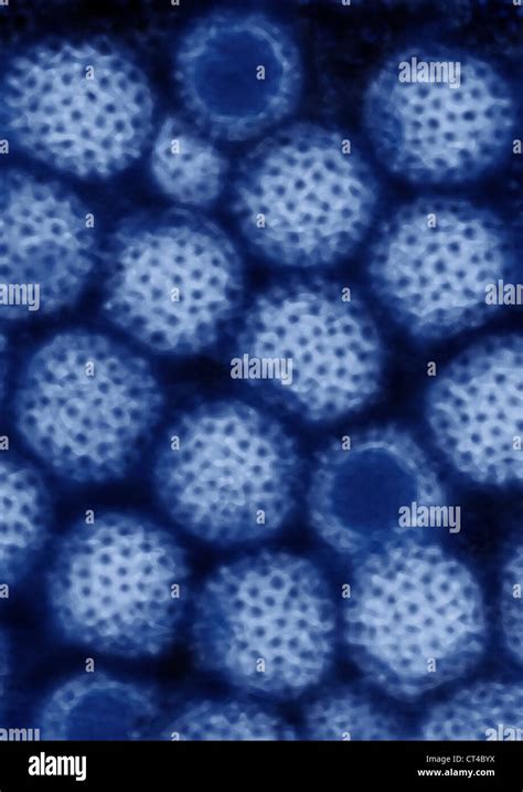 REOVIRUS Stock Photo - Alamy