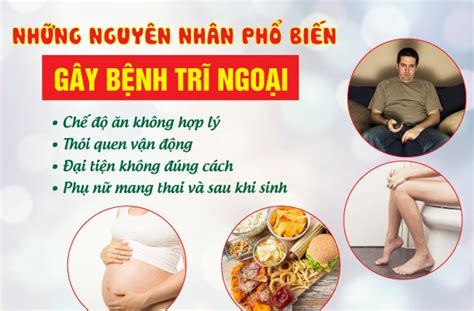 Nguyên nhân bị trĩ ngoại & giải pháp điều trị hiệu quả - Phòng khám Đa Khoa Thủ đô Vĩnh Phúc