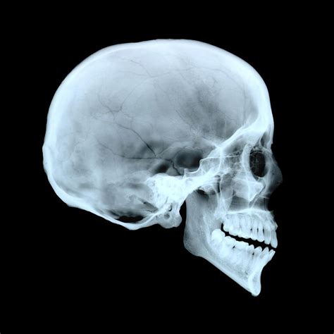 Pin on Head - Skull | Skull wall art, Human anatomy art, Skull