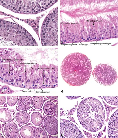 Interstitial Cells Histology