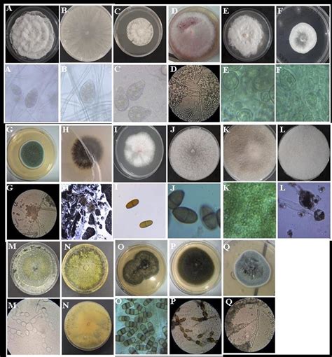 Colony morphology and microscopic features of the fungi isolated on... | Download Scientific Diagram