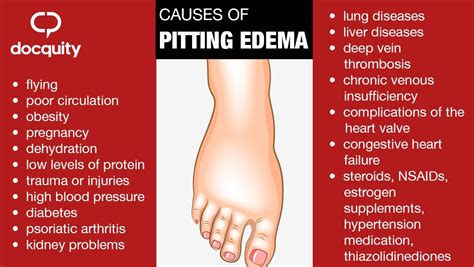 Pitting Edema Pregnancy