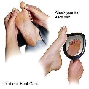 Diabetic Foot Ulcers - What You Need to Know