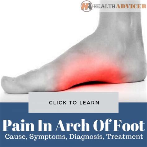 Pain In Arch Of Foot: Causes, Picture, Symptoms And Treatment