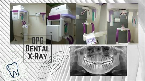 5 things to know about OPG or Dental X-Ray | Primedeq-Blog