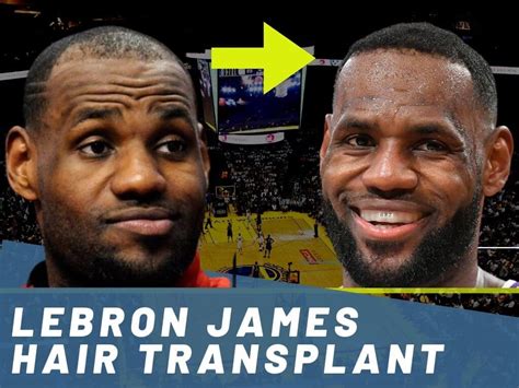 Lebron Hairline Timeline 2022