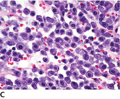 Mast Cell Histology