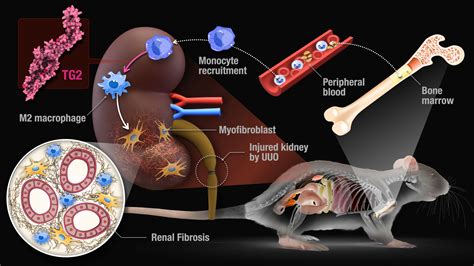 Researchers identify two enzymes involved in macrophage polarization in ...