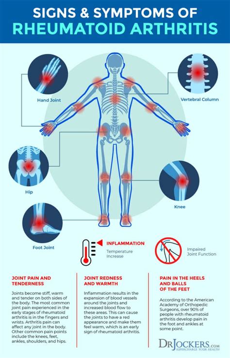 Rheumatoid Arthritis: Symptoms, Causes and Natural Support Strategies