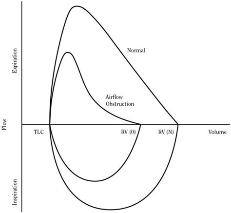 Figure 4.7, Flow-volume loops for a person with (obstruction) and ...