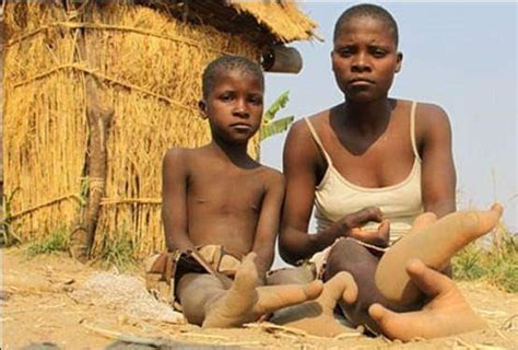 Meet A Tribe Whose People Have Just Two Toes, Zimbabwe’s Bantwana Tribe – Face of Malawi