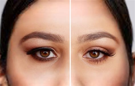 Drooping Eyelid Celebrities With Hooded Eyes – Contours Rx