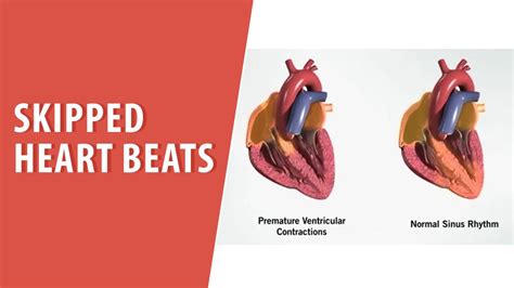 Texas Cardiac Arrhythmia | Trusted Patient Education Platform