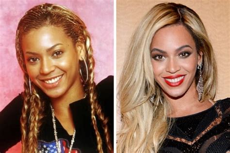 Bleaching Skin Before And After Beyonce