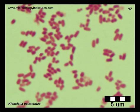 Klebsiella pneumoniae microscopy, Gram-stain. Klebsiella pneumoniae under microscope. Gram ...