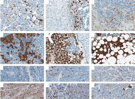 Localization patterns and morphology of CD68-positive cells of the... | Download Scientific Diagram