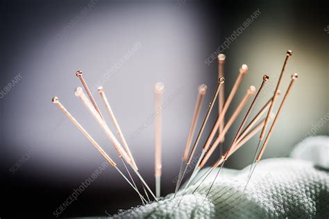 Acupuncture needles - Stock Image - C034/7886 - Science Photo Library