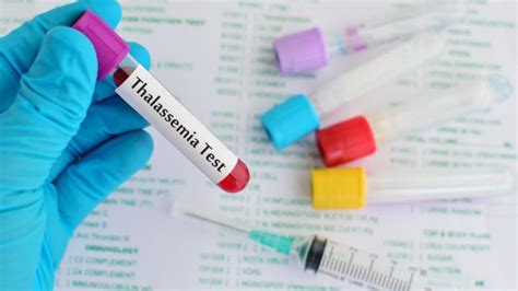 Understanding all about thalassemia treatment