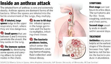 Anti-Anthrax Vaccine developed - Preventions from Anthrax