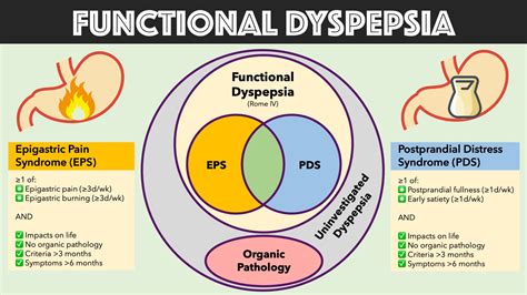 Functional Dyspepsia: Diagnosis and Treatment