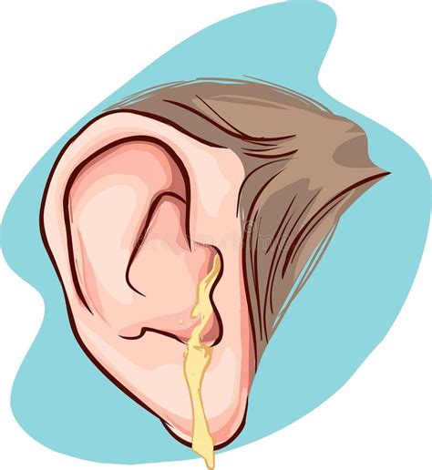 Ear infection stock vector. Image of image, ready, infection - 62881286