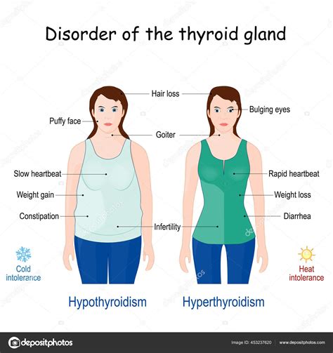 Thyroid Gland Disorder Comparison Difference Hyperthyroidism ...