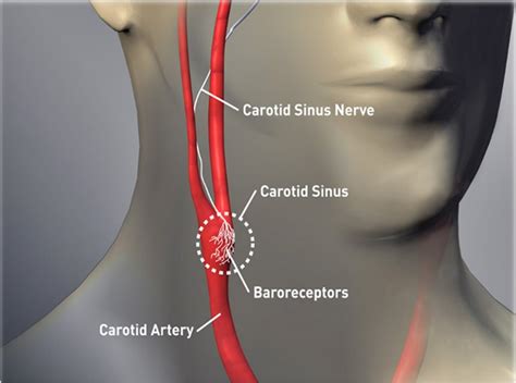 Carotid Artery In The Neck & Why You Shouldn't Coil or Twist This Part