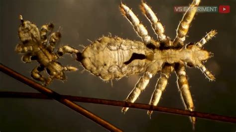 INILAH KUTU RAMBUT DAN TELURNYA DI MIKROSKOP Head Lice Under Microscope ...