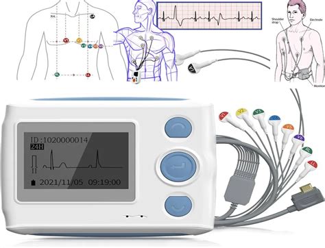 What is the Holter Monitor: Working Principle, Best Uses and Types 24