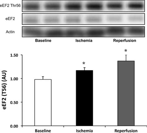 Increased phosphorylation of eukaryotic elongation factor-2 (eEF2 ...