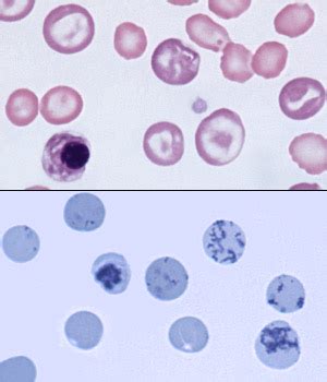 Canine reticulocytes | eClinpath