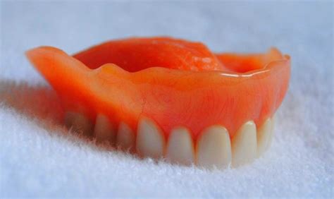 alternatives-to-dentures | Kuipers Ortho