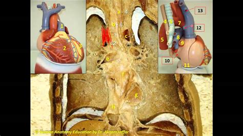 Identifying mediastinal structures in a coronal section - YouTube