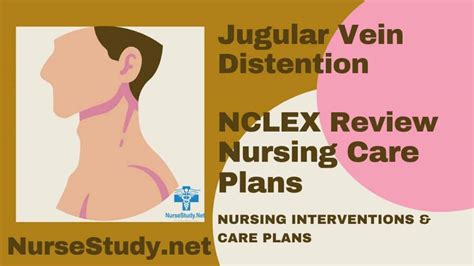 Jugular Vein Distention JVD Nursing Diagnosis and Nursing Care Plan ...