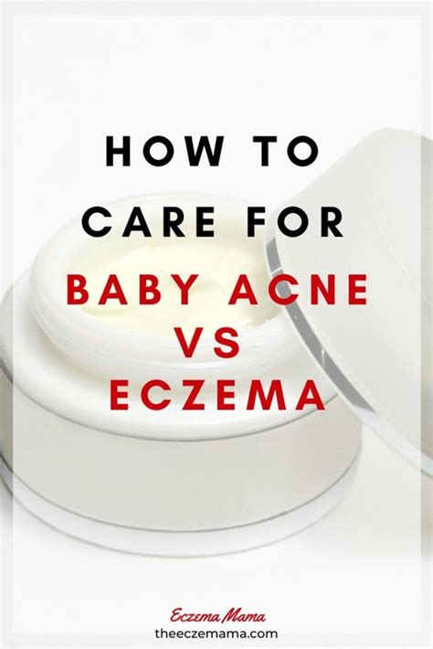 How to Care for Baby Acne vs Eczema - Eczema Mama