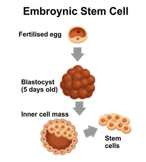 Stem Cell Therapy in Mumbai, India - NeuroGen BSI