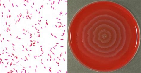 Biochemical Test of Proteus mirabilis