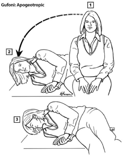 Gufoni maneuver for treatment of right-sided lateral semicircular canal... | Download Scientific ...