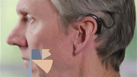 Nucleus 8 Sound Processor | Wearing options for adults | Cochlear - YouTube