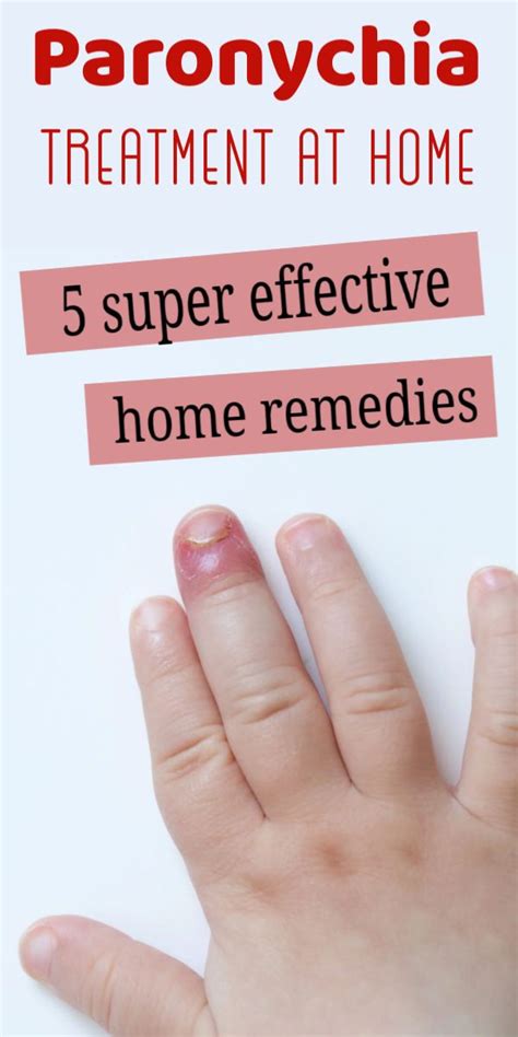 Paronychia Treatment By 5 Super-Effective Home Remedies #paronychia # ...