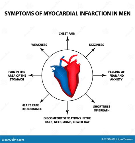 Symptoms of Myocardial Infarction in Men. a Heart Attack. World Heart ...