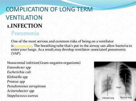 Complication of long term ventilation