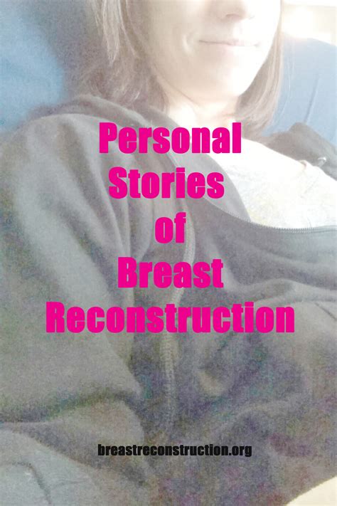 personal stories – Life Reconstructed