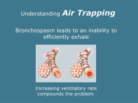 PPT - Airway Management Part II PowerPoint Presentation, free download ...