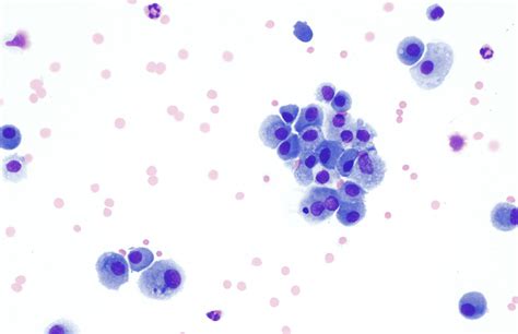 Macrophage Histology