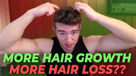 More Hair Growth On Your Body = More Hair Loss On Your Head - YouTube