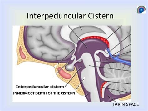 Cisterns of brain