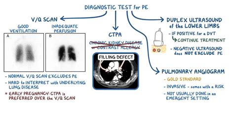 Venous thromboembolism: Clinical: Video & Anatomy | Osmosis