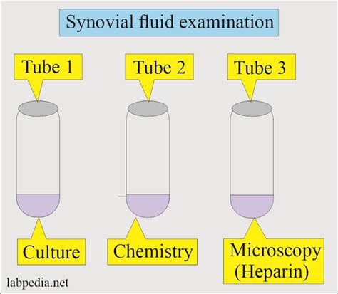 Fluid Analysis:- part - 8 - Synovial Fluid Analysis, Procedure for Arthrocentesis